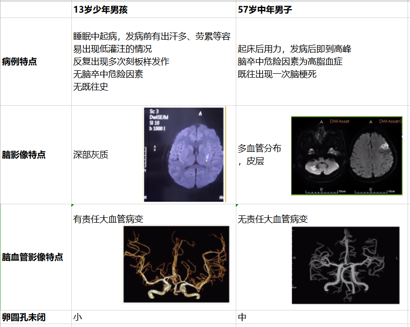 心对话丨卵圆孔未闭相关性卒中，你是否能正确处理？