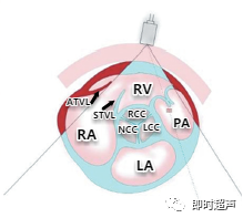 多图片解读超声心动图瓣膜分布，干货满满，快来收藏！