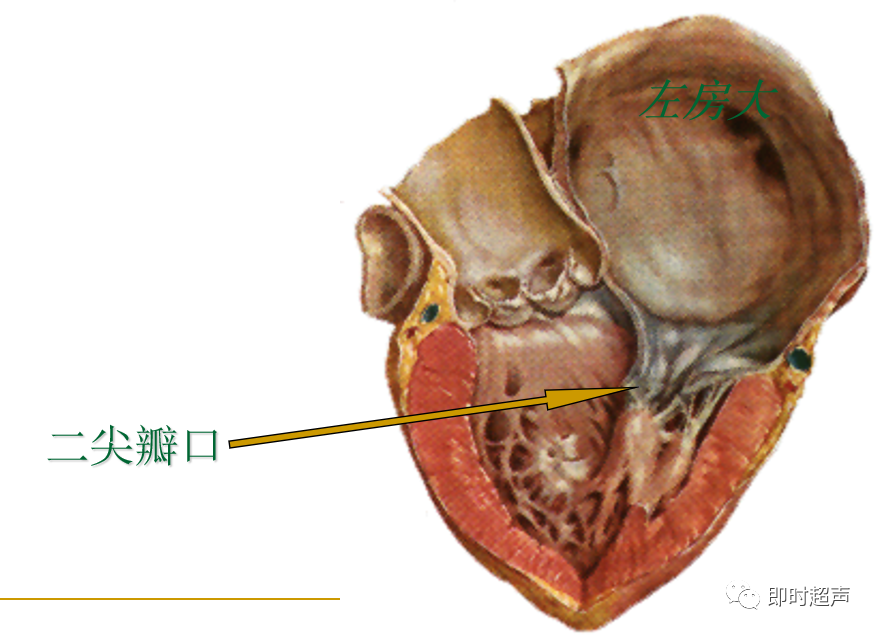 心脏瓣膜病超声诊断