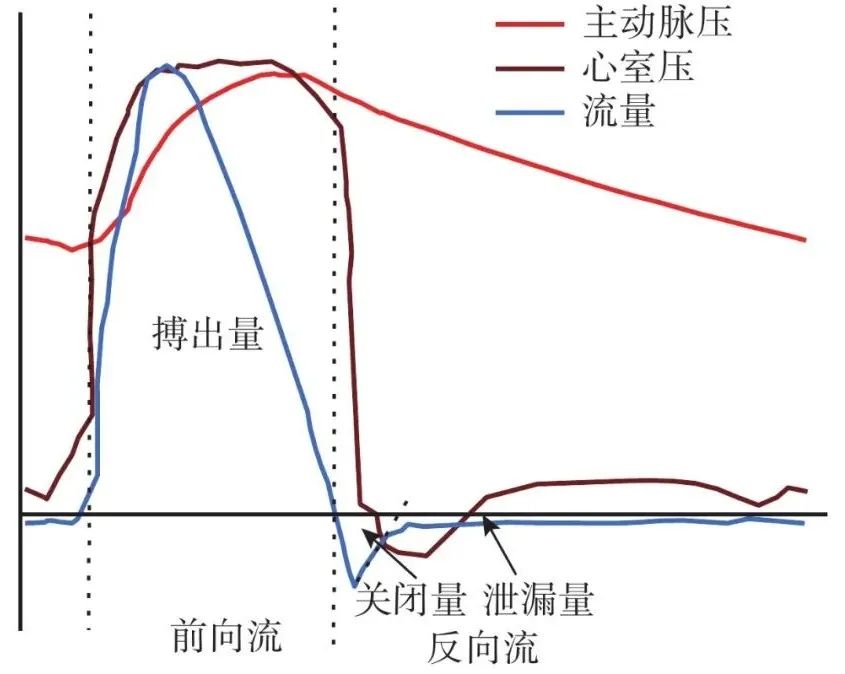 【学术】结构性心脏病时代医工结合：人工心脏瓣膜体外血流动力学性能测试及其临床意义