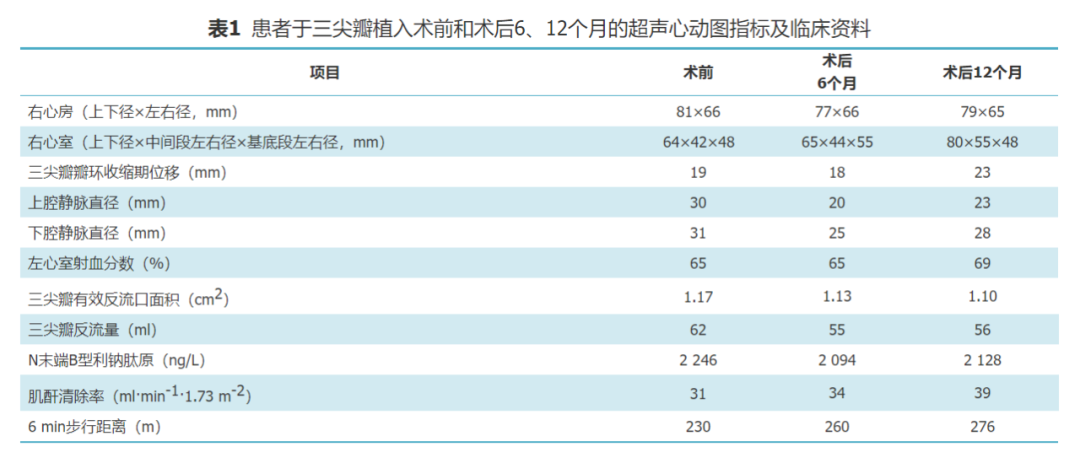 【病例报告】应用异位三尖瓣植入术治疗重度三尖瓣反流1例