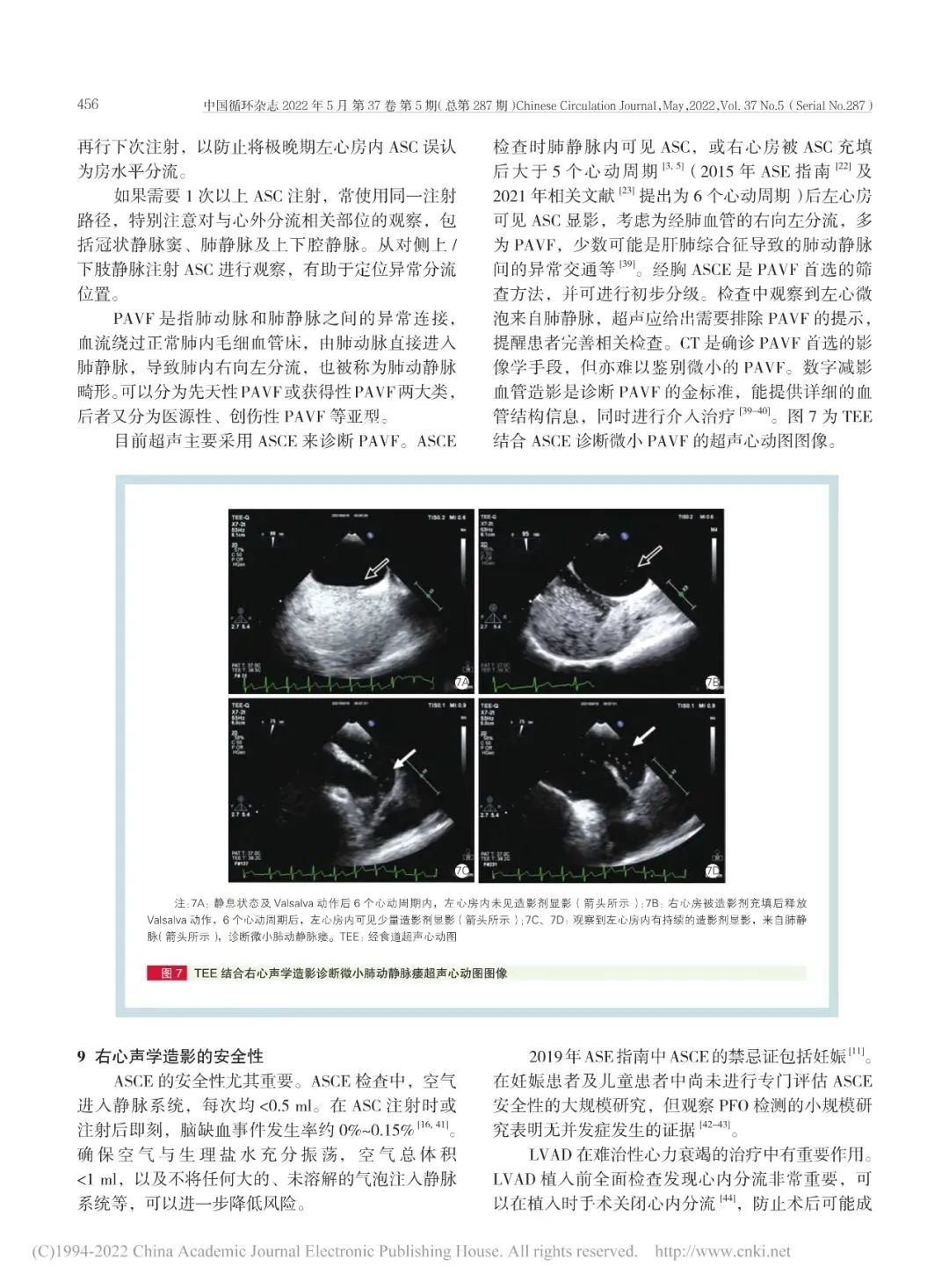 卵圆孔未闭该如何诊疗？我国最新专家共识来了！