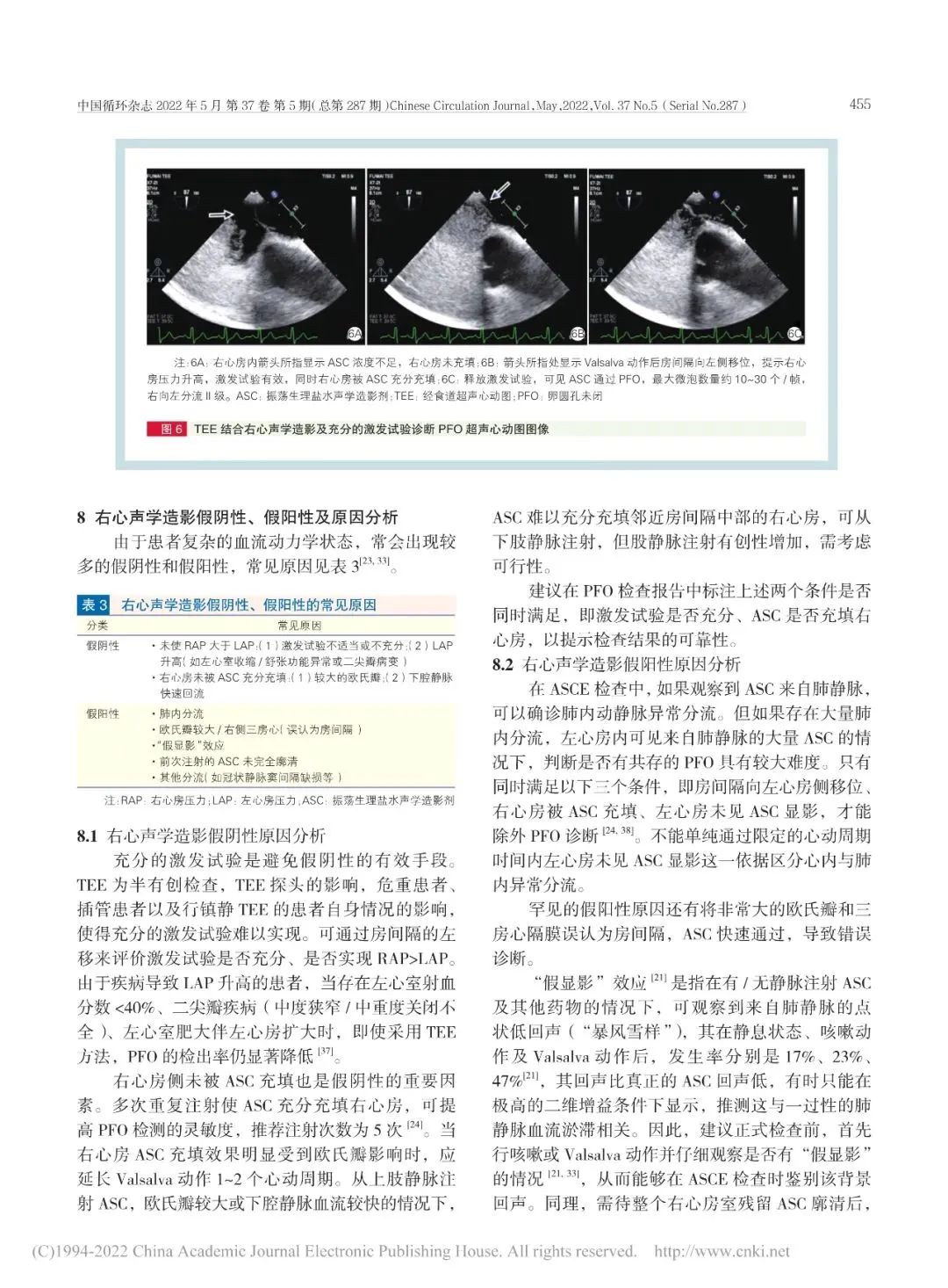 卵圆孔未闭该如何诊疗？我国最新专家共识来了！