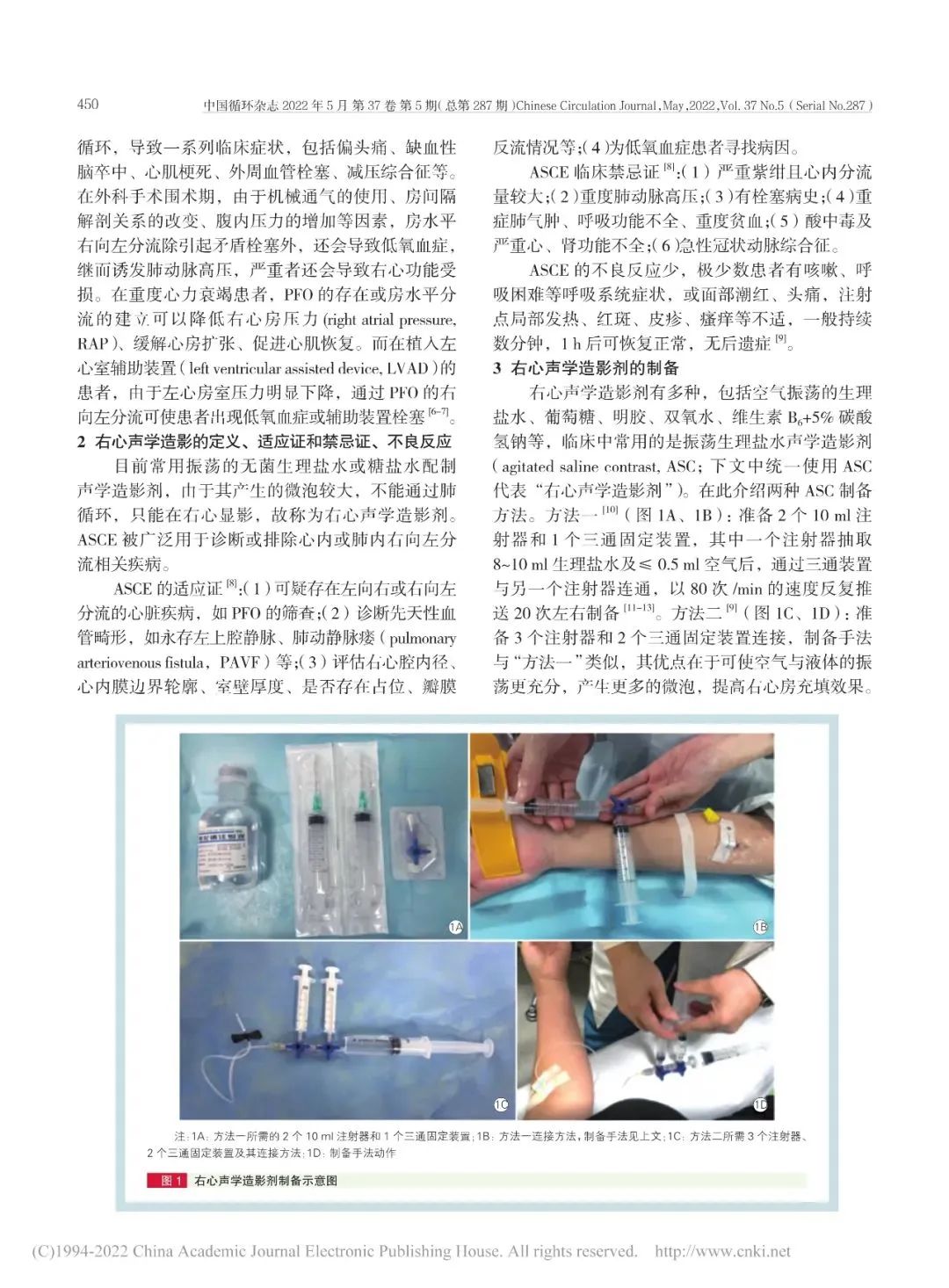 卵圆孔未闭该如何诊疗？我国最新专家共识来了！